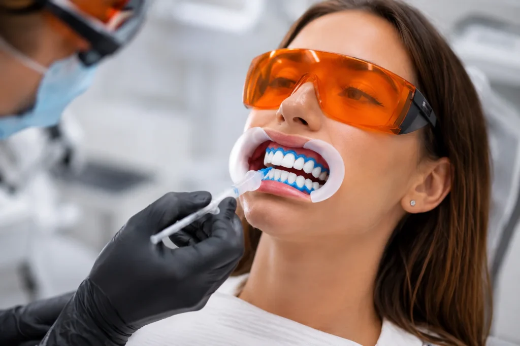 Dentist performing in-office teeth whitening treatment